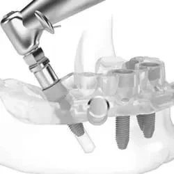 Cirurgia guiada para implantes dentarios